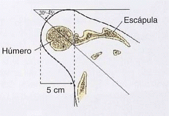 Diagrama Oblicua Glenoides